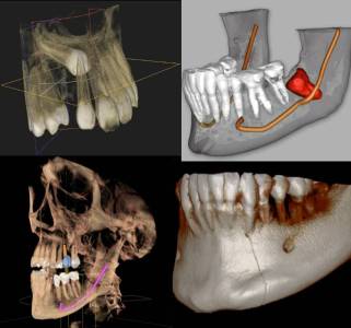 3D cone beam x-ray