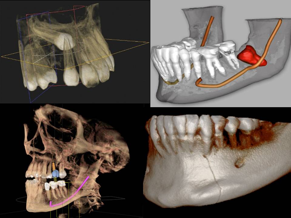 sedante dentista