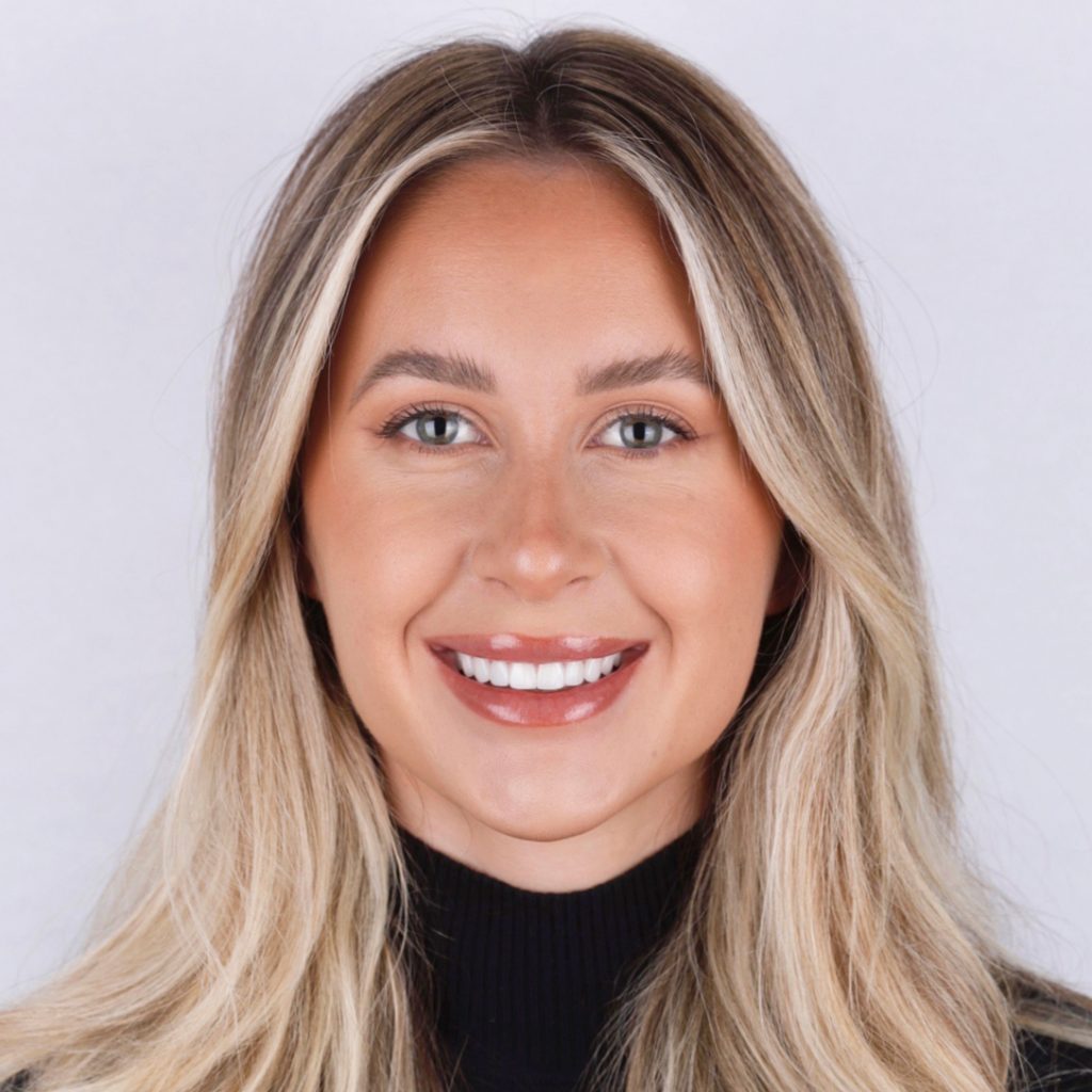 teeth veneers before and after2
