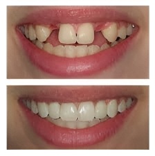 implant specialist