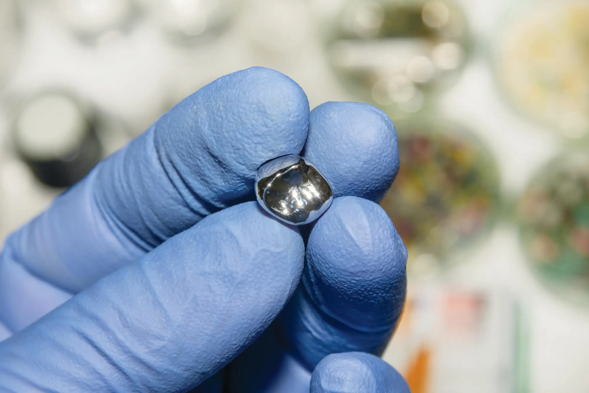 Burtonsville Dentist That Removes Mercury Fillings