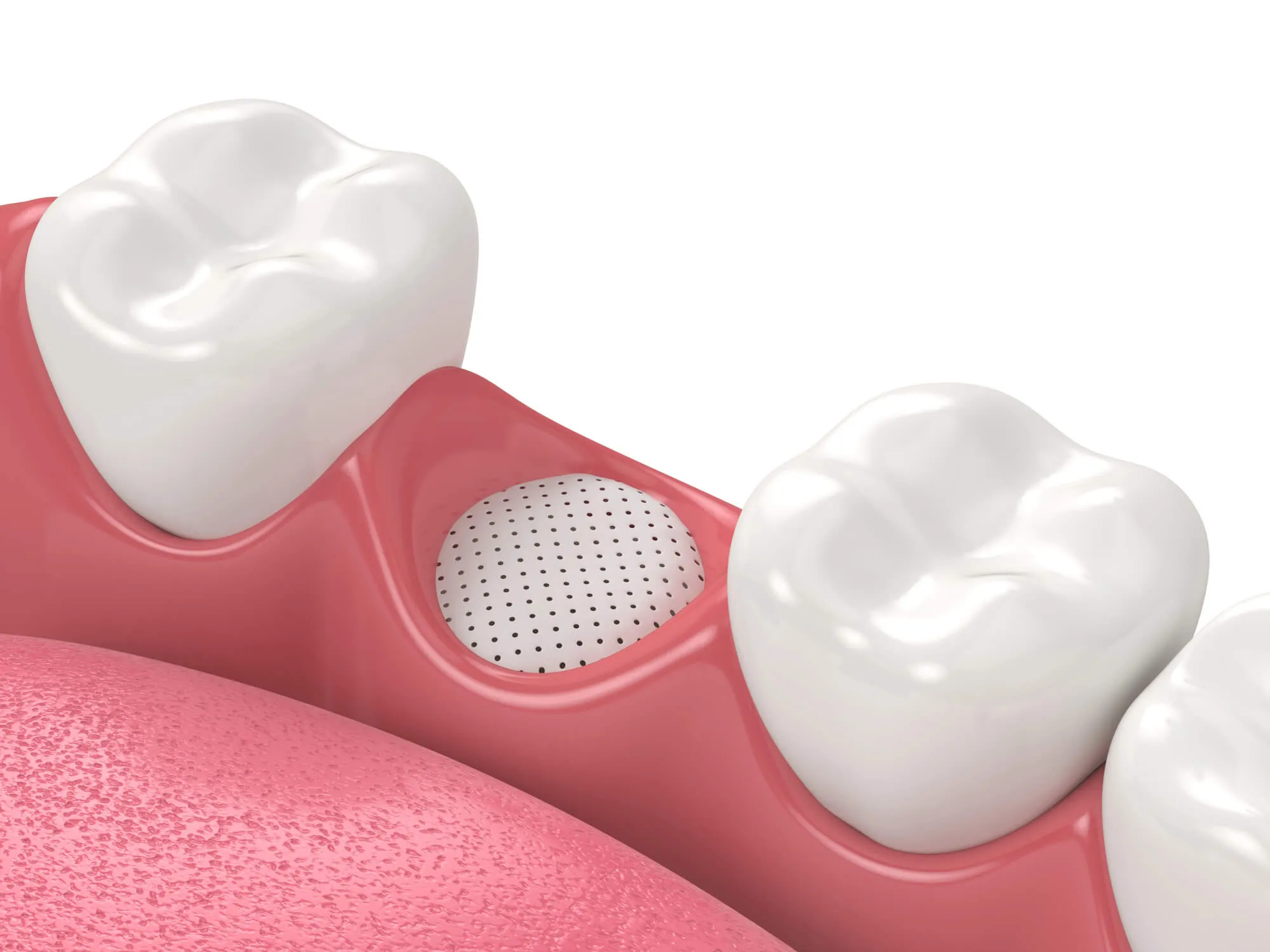 before oral surgery Montgomery county