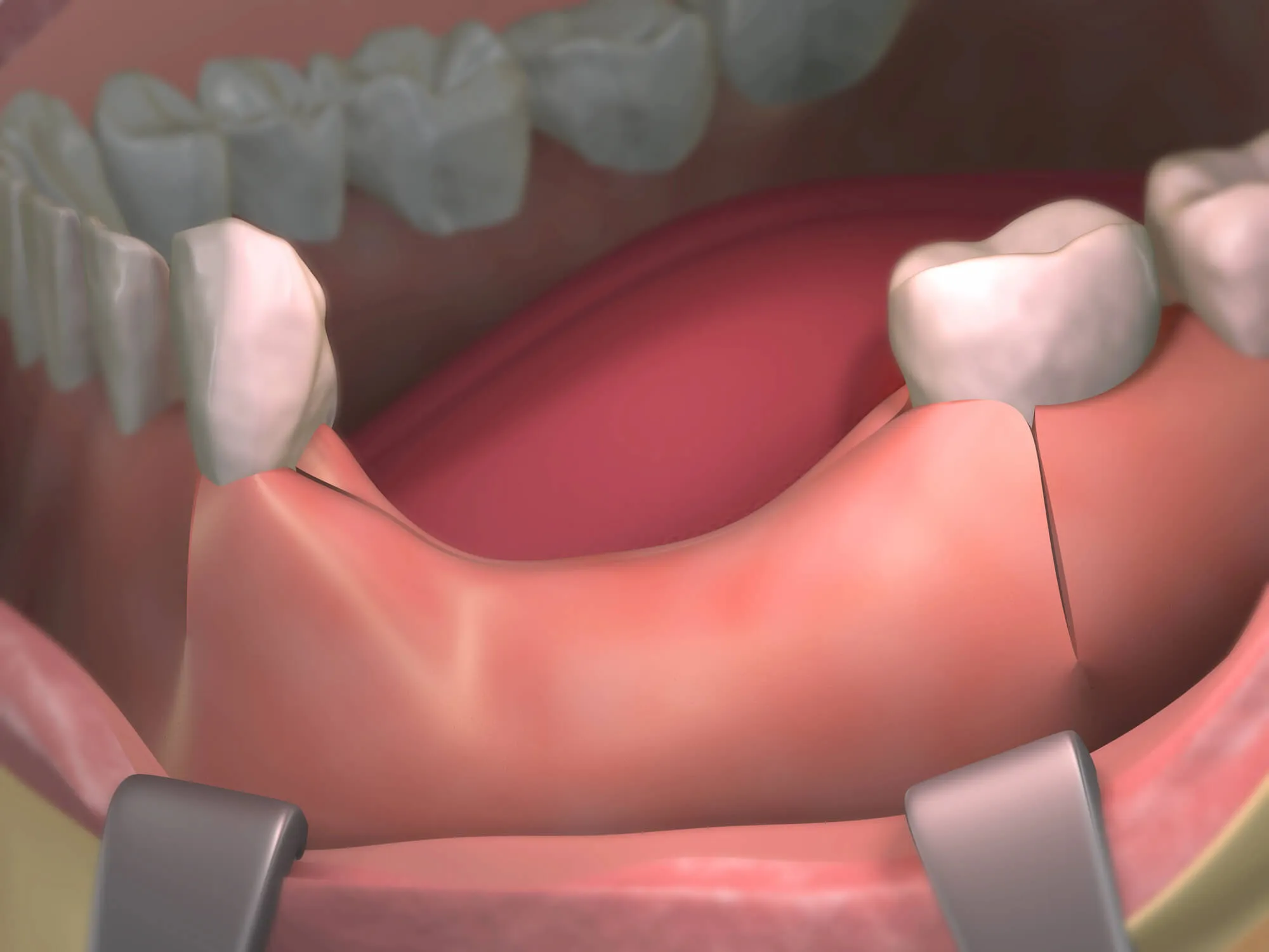 ongoing oral surgery Montgomery county