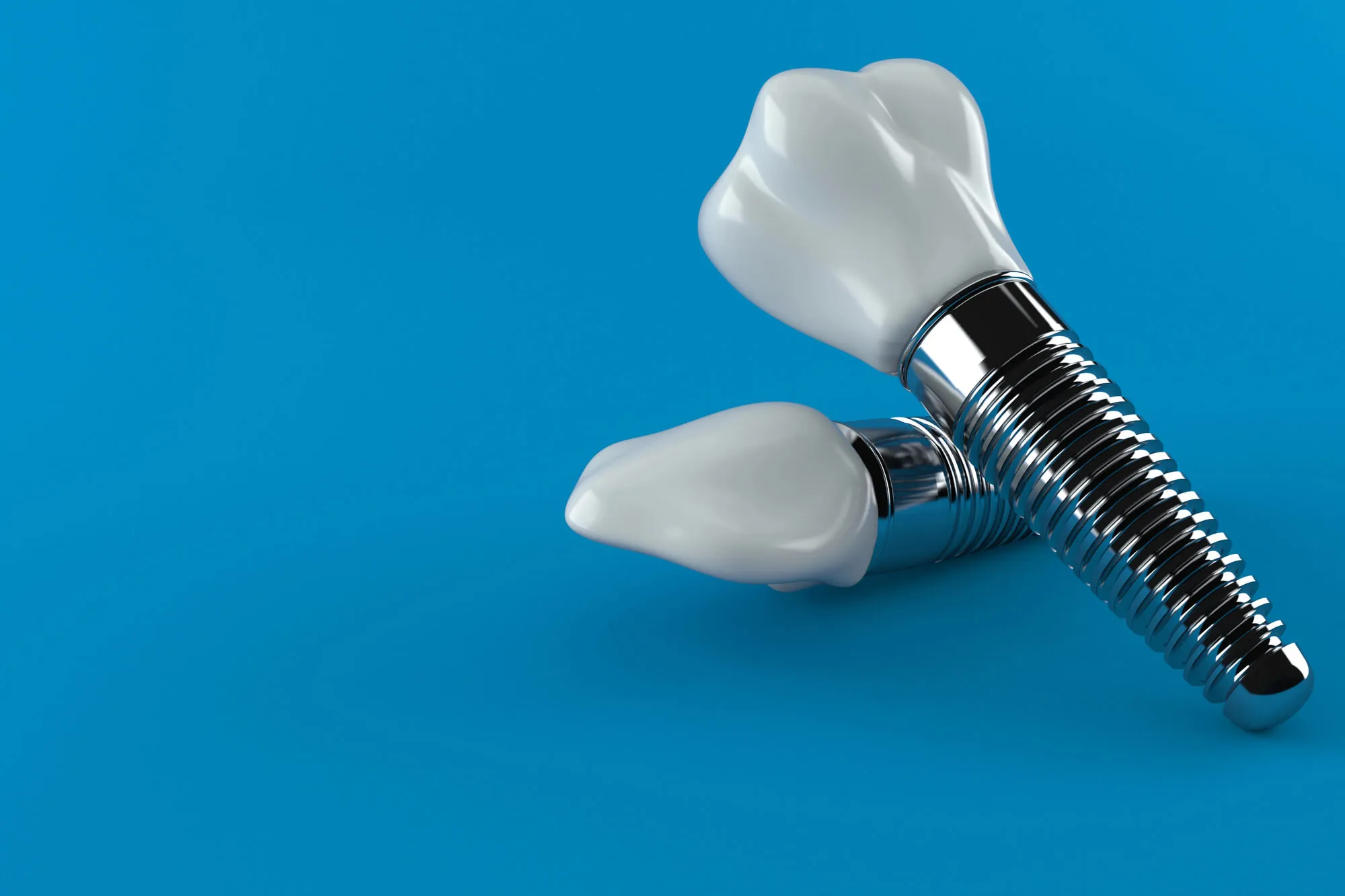 Full Mouth Dental Implant Costs: What a Consultation Usually Covers