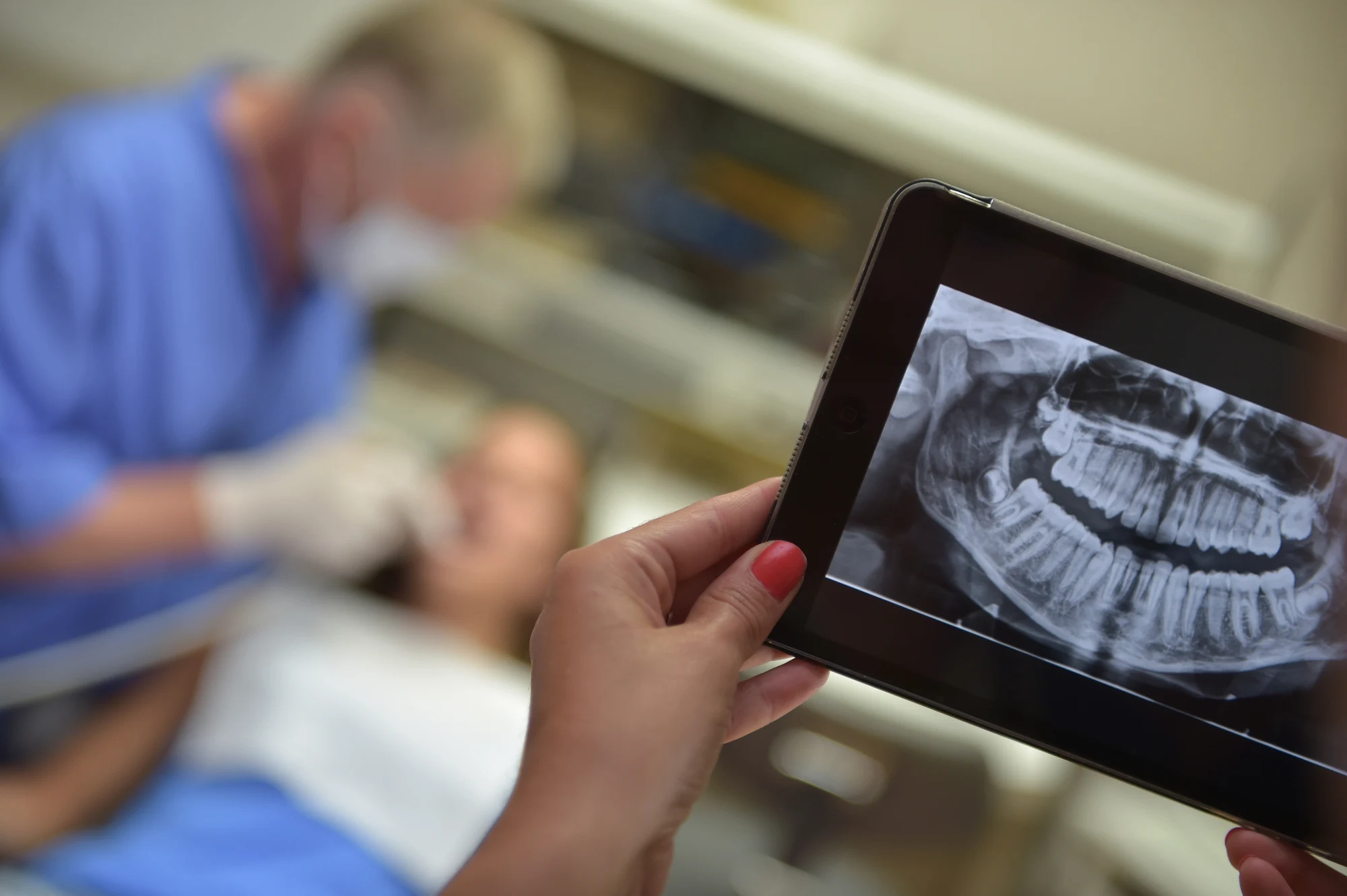 How Do Dental X-rays Help Detect Cavities & Other Oral Issues?