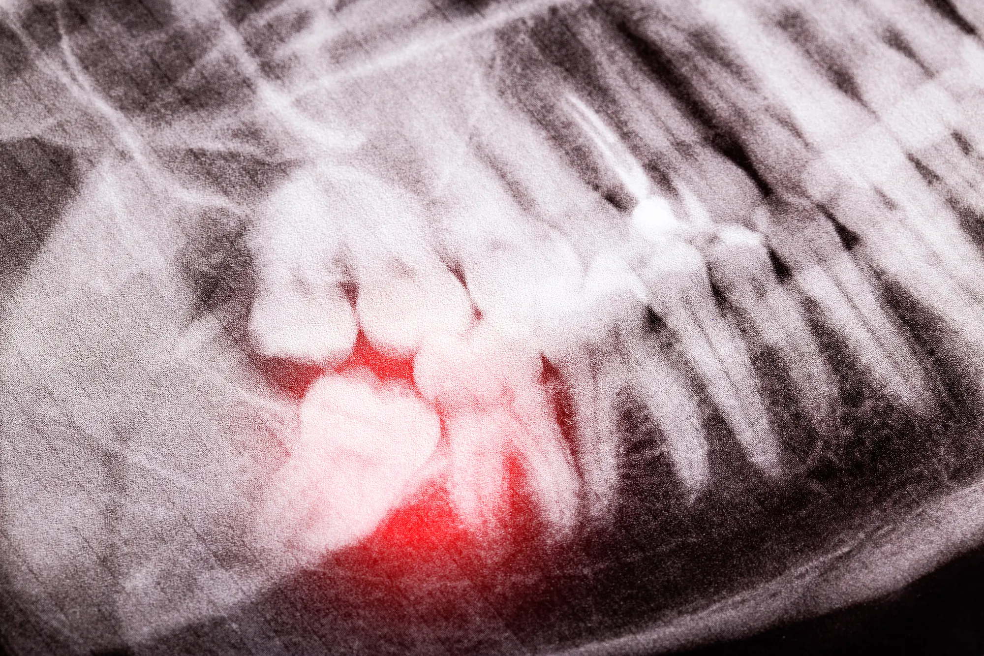 dental-problem-needing-an-emergency-dentist