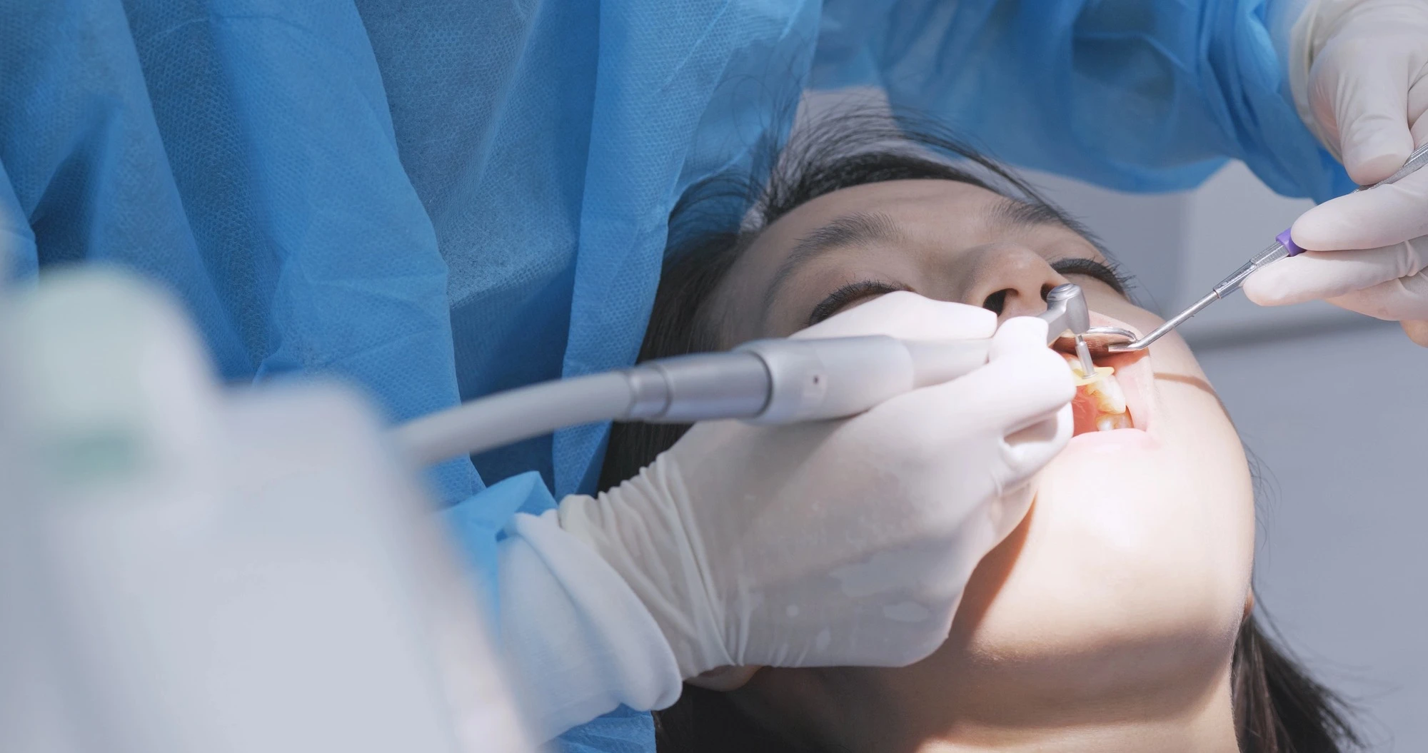 oral surgery montgomery county surgical dental procedure