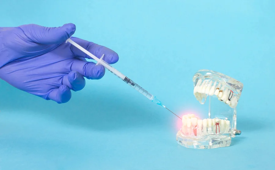 iv-sedation-dentistry-maryland-sedation-injection-model
