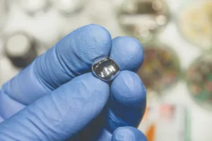 removed-amalgam-filling-displayed-during-safe-removal-montgomery-county